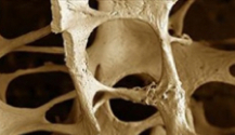 Abaloparatide molto bene in fase II nell’aumentare la densità ossea