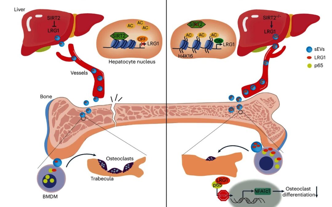 Crosstalk osso-altri organi: SIRT2 alla base dell’interazione Fegato-Osso