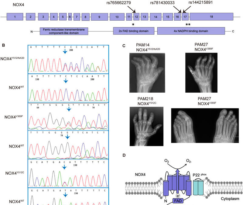 Nuove varianti rare del gene NOX4 coinvolte nel differenziamento degli osteoclasti