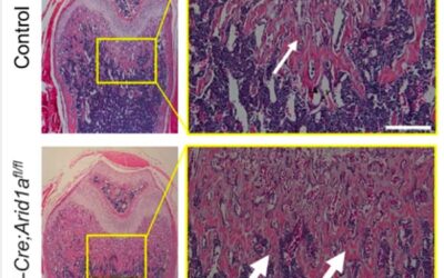 ARID1A: il guardiano del differenziamento degli osteoclasti