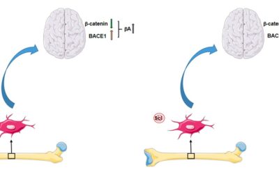 Asse cervello-osso: sclerostina, molecola chiave per la perdita di massa ossea e malattia di alzheimer